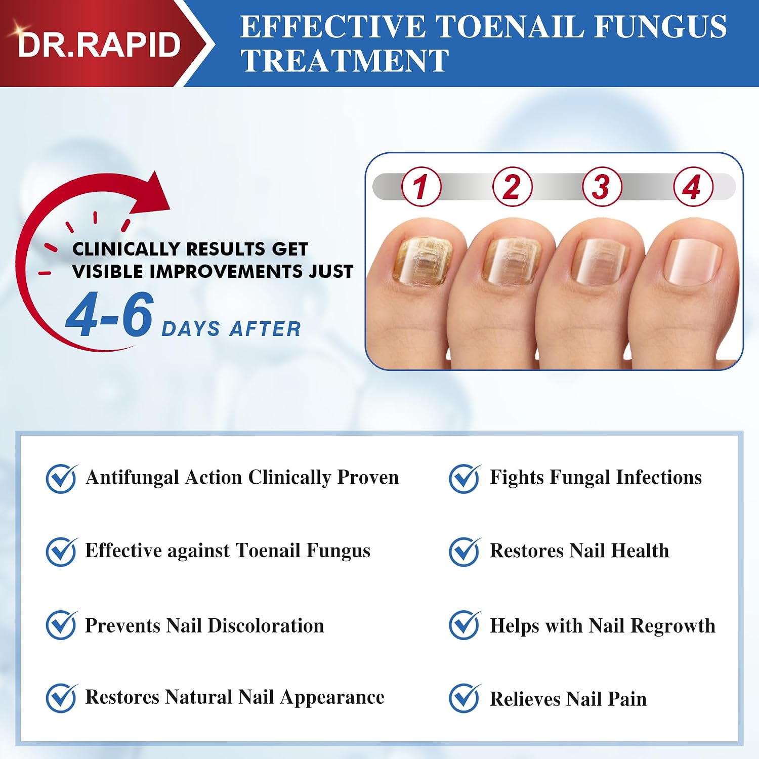 Detalle 1 de Toenail Fungus Treatment with 25% Undecylenic Acid
