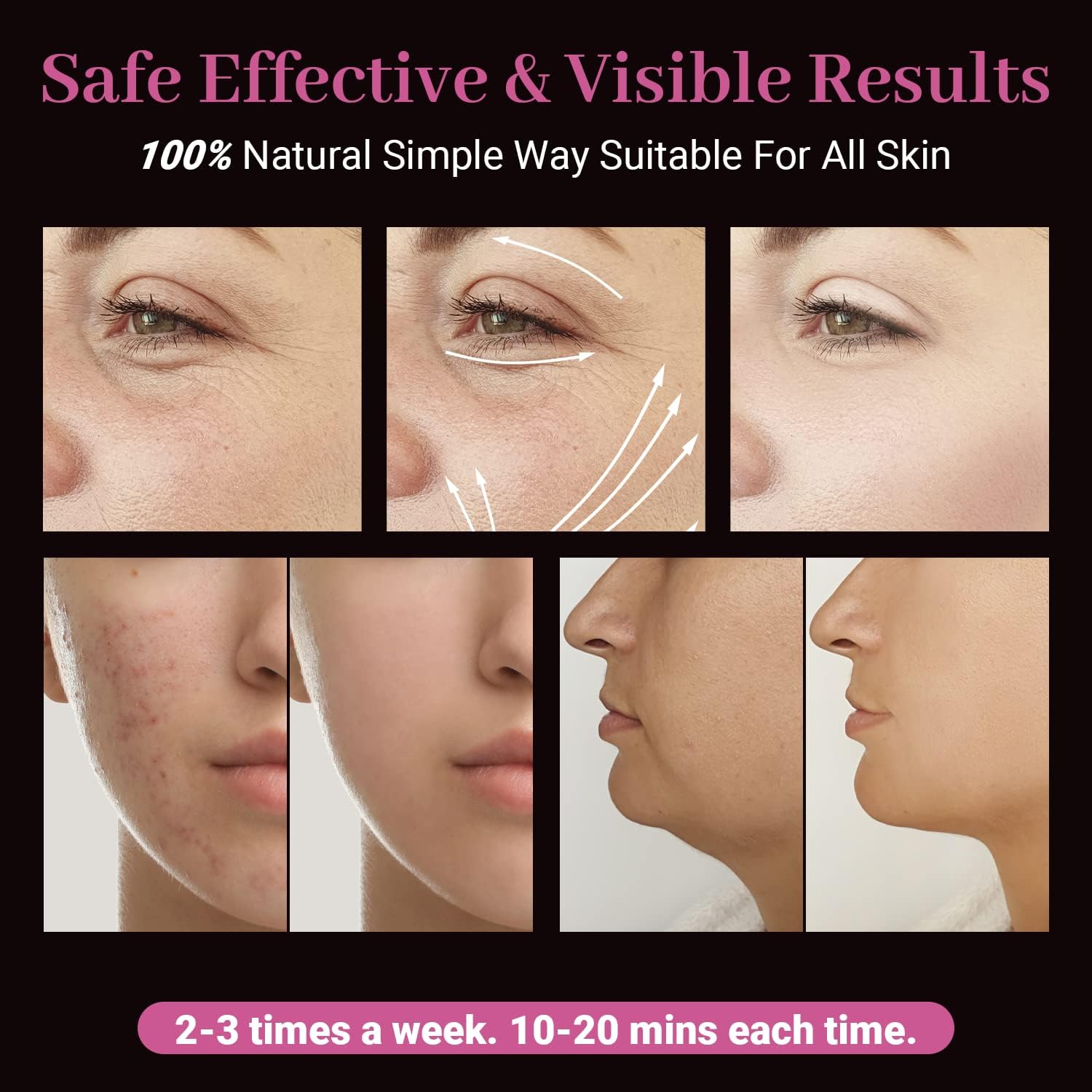 Detalle de UUPAS Alta Frecuencia Estetica Facial portátil