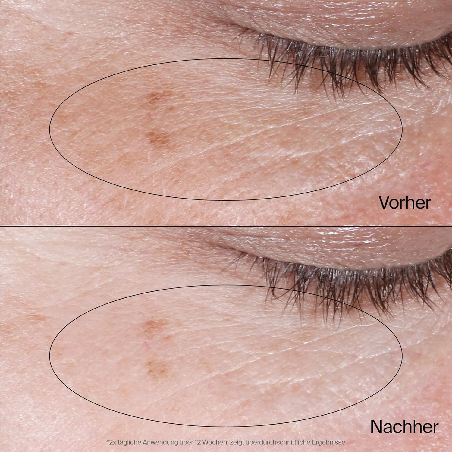 Detalle de Neutrogena Collagen Bank Belebende Augen-Gel-Creme – parfumfrei, 15 g