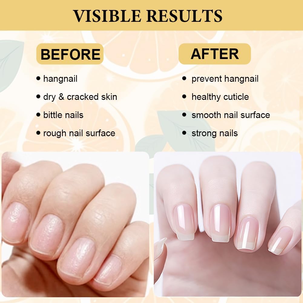 Thumbnail 2 de LOPHE Huile pour cuticules et ongles 15 ml Orange Douce – nutrition intense et brillance