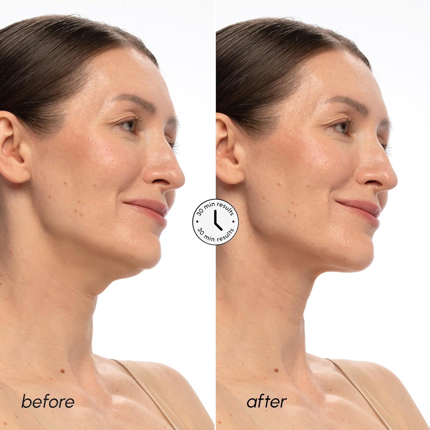 Thumbnail 2 de MAREE V Line Lifting Mask with PDRN Salmon DNA – Deep Neck & Jawline Contour Mask