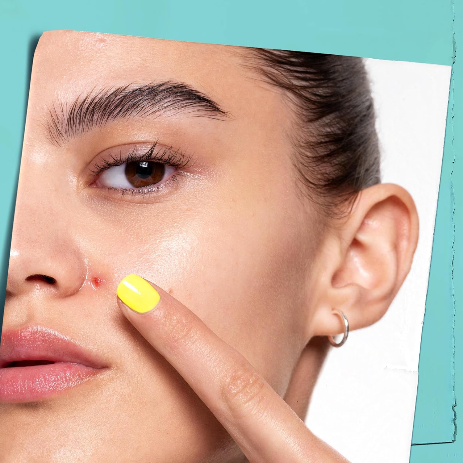 Thumbnail 3 de Kiehl’s Truly Targeted Blemish Clearing Solution (15 ml) – unsichtbares flüssiges Pickel-Patch mit Salicylsäure
