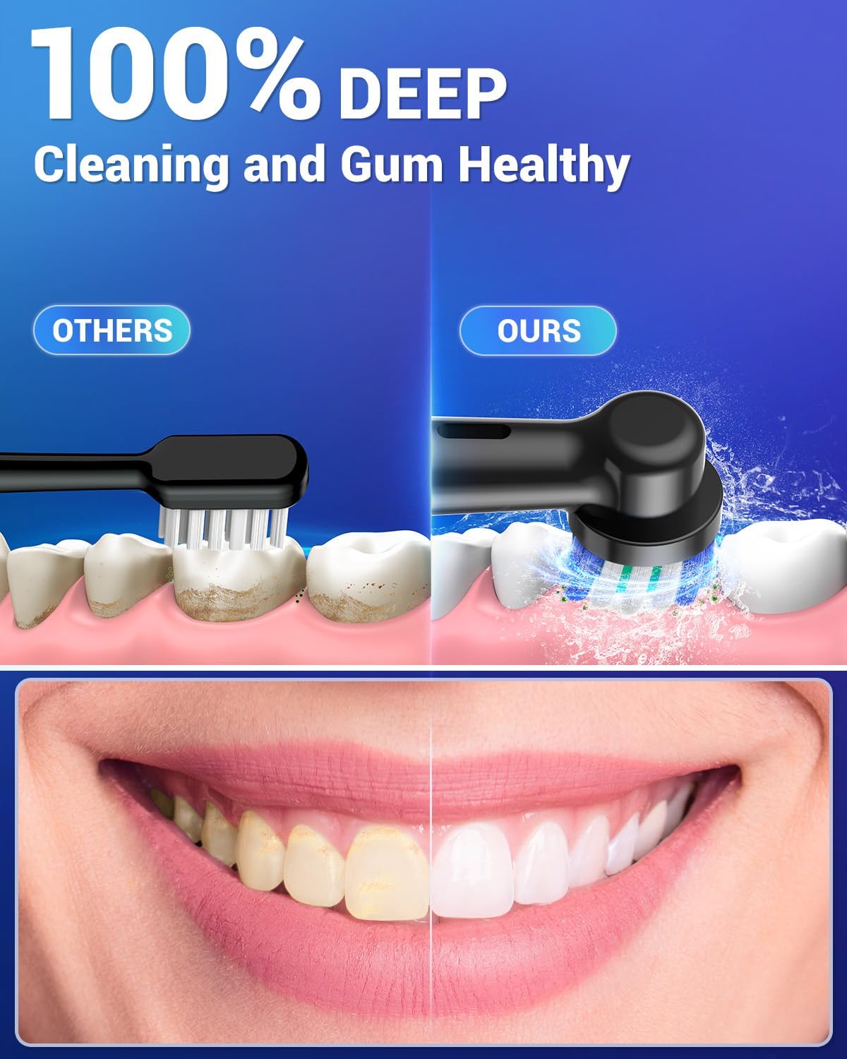Thumbnail 2 de Rotating Electric Toothbrush 50,000