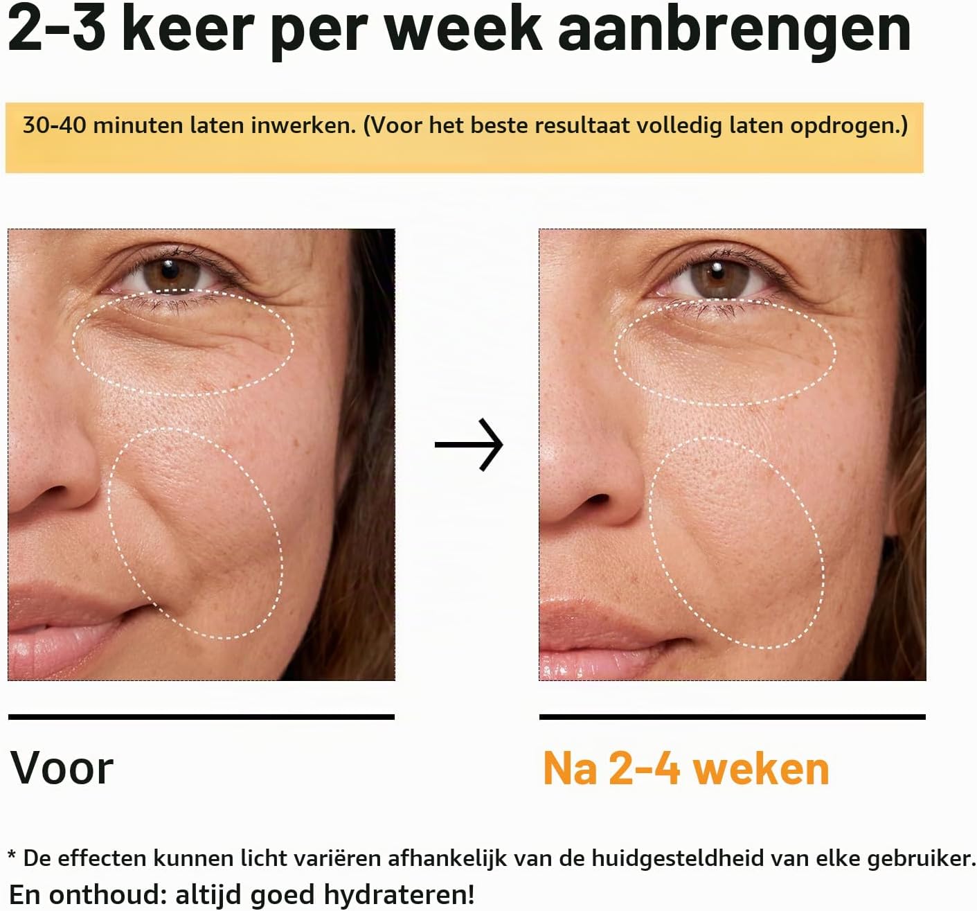 Thumbnail 5 de RAZUYEN RAMSKT3 gezichtsmasker met hyaluronzuur en peptiden, 10 stuks
