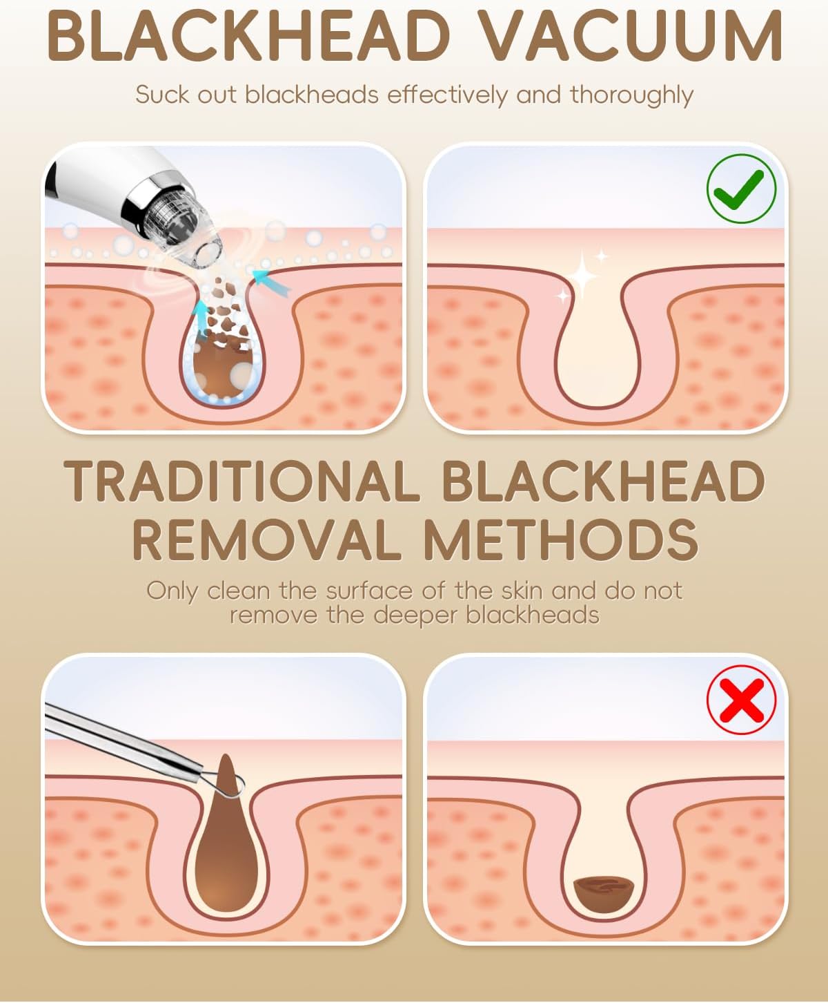 Detalle de Pore Vacuum Blackhead Remover - Pore Extractor with 5 Attachments & 3 Suction Levels (White)