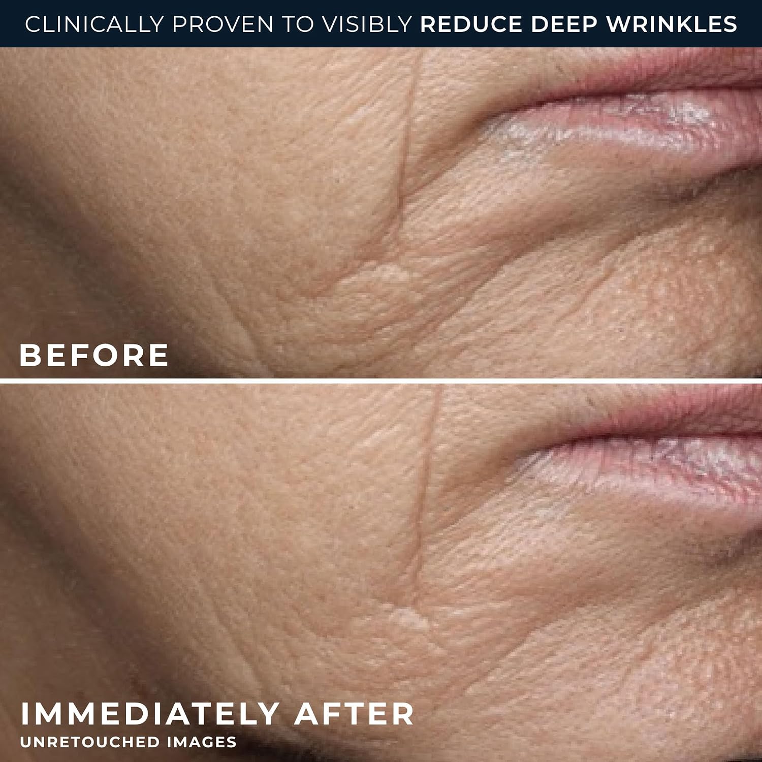 Detalle 2 de RoC Deep Wrinkle Rich Cream, Fragrance-Free Daily Firming Moisturizer, 50 mL