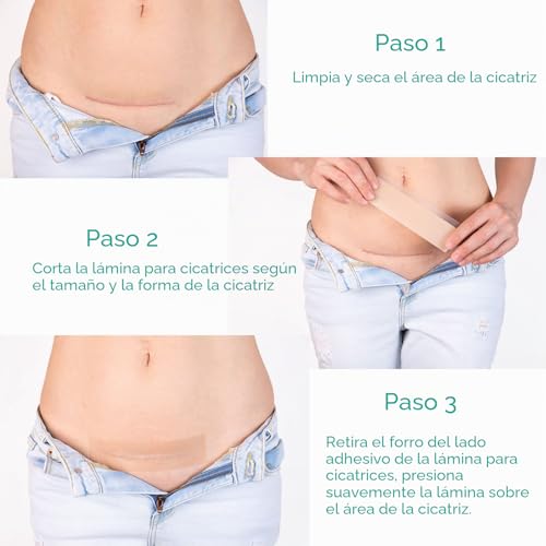 Detalle 2 de NVXNMSD Silicone Scar Sheets: Parches de Silicona para Cicatrices Verdes, 1.6'' x 60