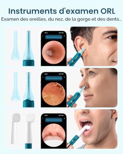 Thumbnail 7 de Bebird Earsight Ultra Détartrant pour Oreilles avec 5G-WLAN et Otoscope HD 1080P – kit complet