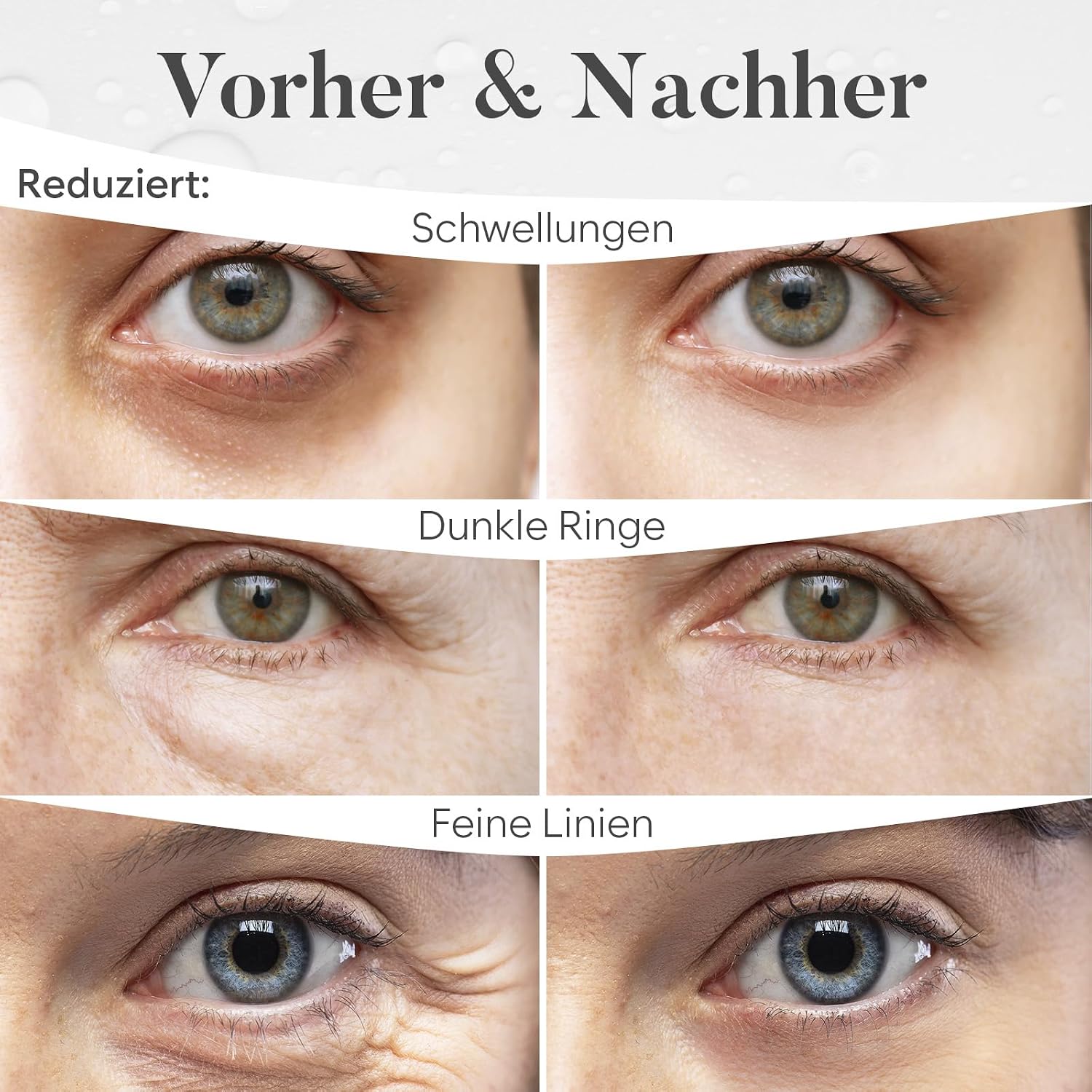 Detalle de BLOOMORA Gemischte Augenpads – 30 Paare mit Niacinamid & Hyaluron