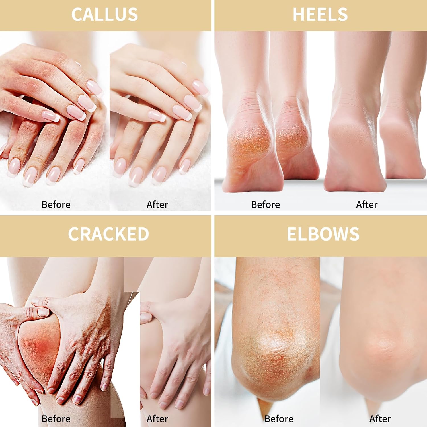 Detalle 2 de Crema Piedi Urea 50% 150g — Idratazione profonda e ammorbidente