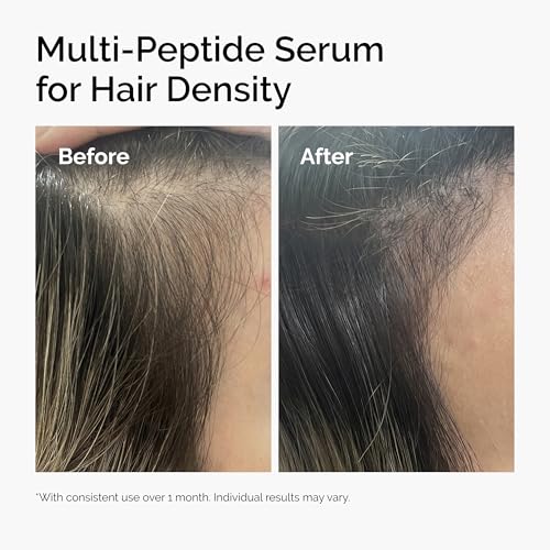 Thumbnail 6 de The Ordinary Multi-Peptide Serum for Hair Density – Peptide-Powered Support for Thicker-Looking Hair
