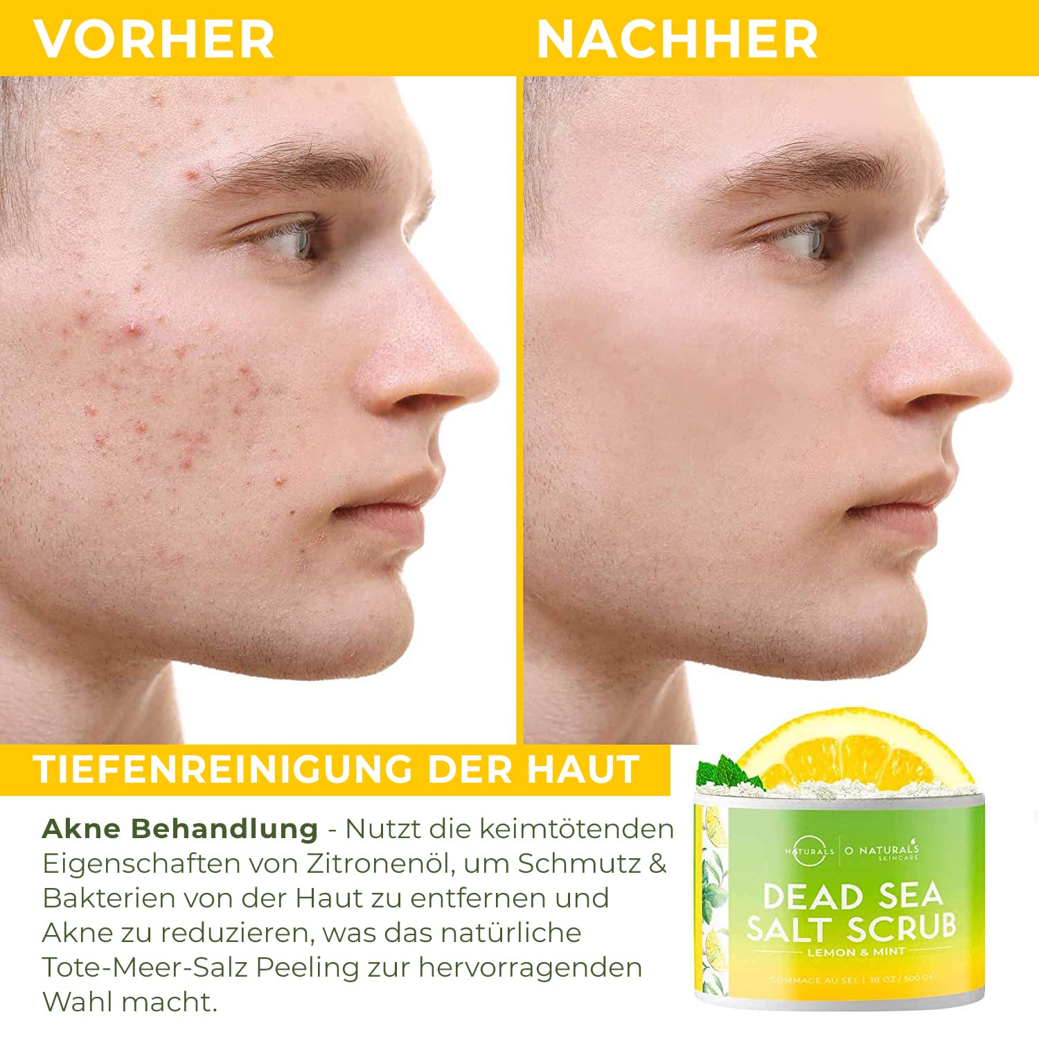 Thumbnail 4 de ONaturals Ultra Körperpeeling 510 g