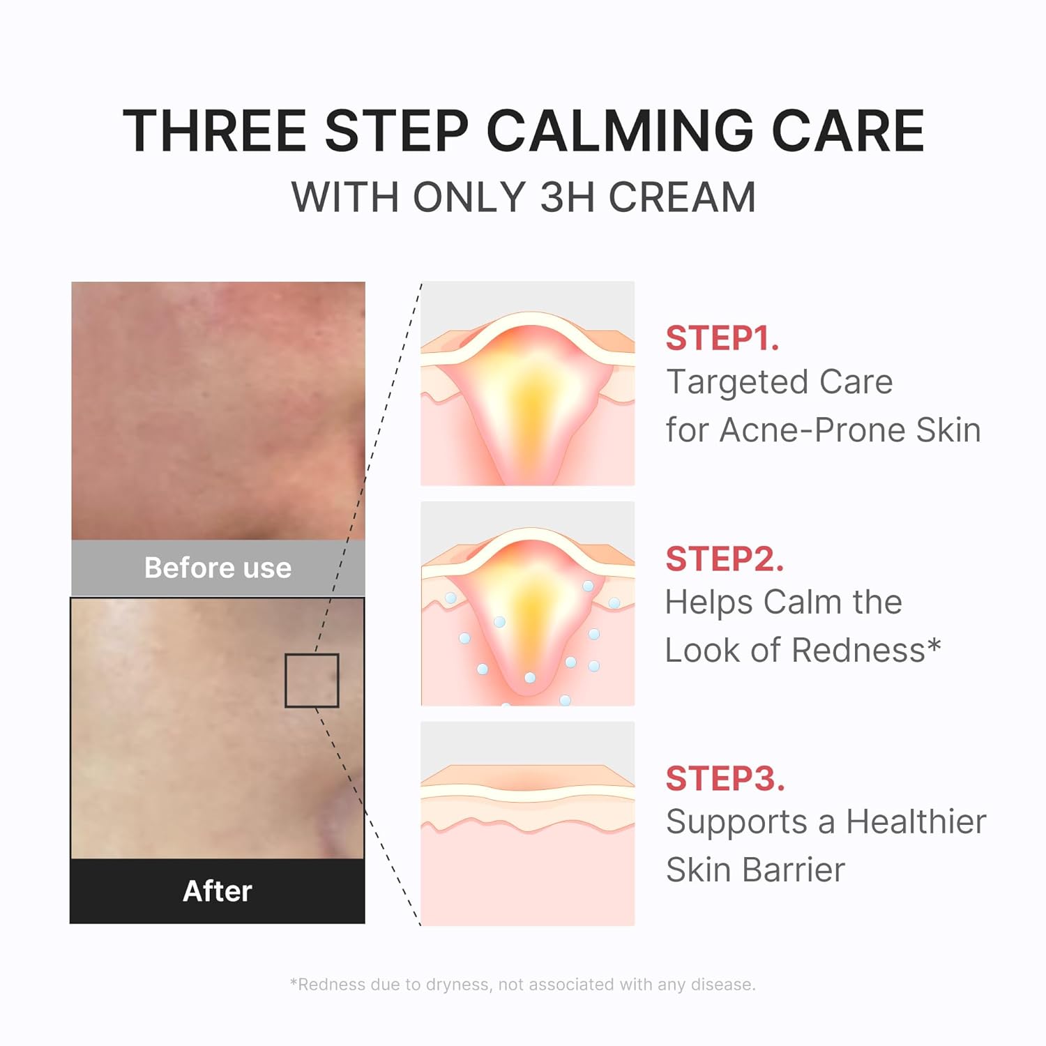 Thumbnail 3 de medicube 3H Daily Relief Cream – Sanfte Feuchtigkeit für alle Hauttypen