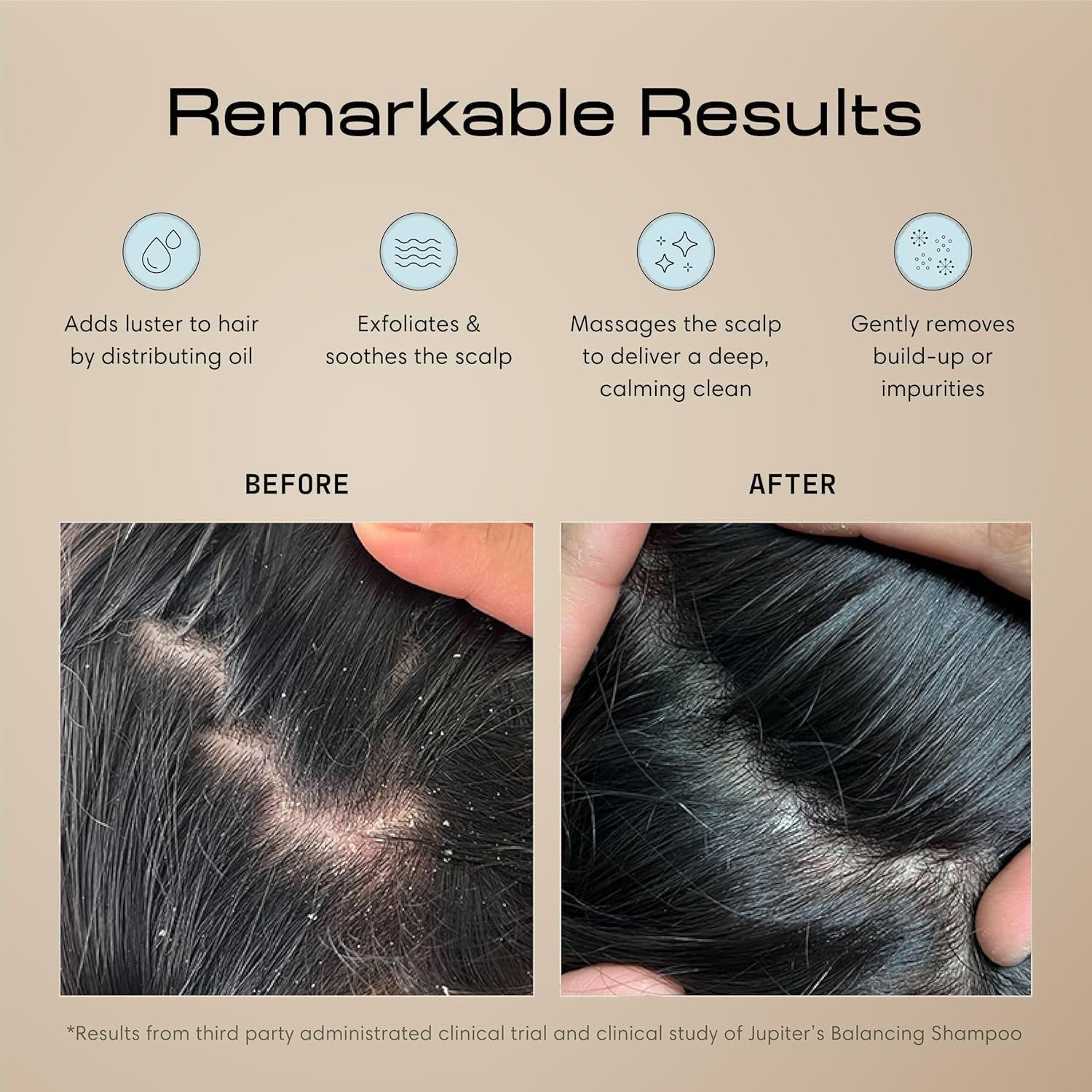 Detalle 2 de Jupiter Scalp Exfoliator scalp brush for dandruff 🪮