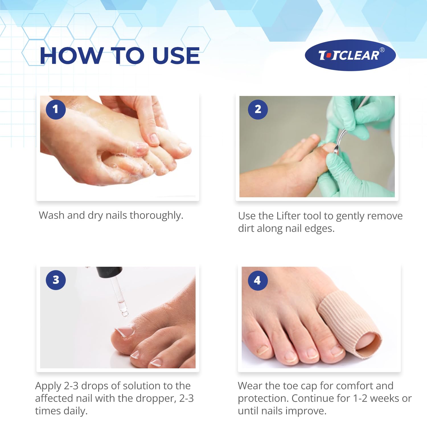Detalle de Ingrown Toenail Relief: 30ml Kit with Drops for Gentle Care