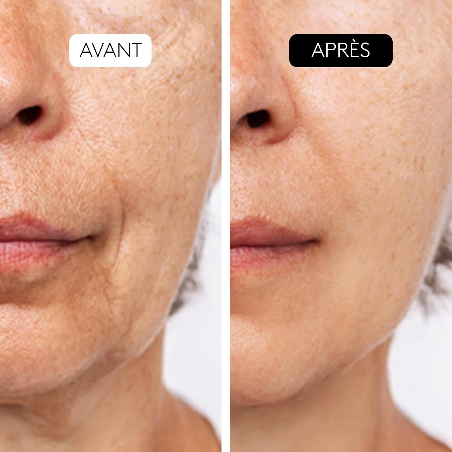 Thumbnail 3 de COCUNAT CLINICAL AHA COMPLEX 10% sérum exfoliant
