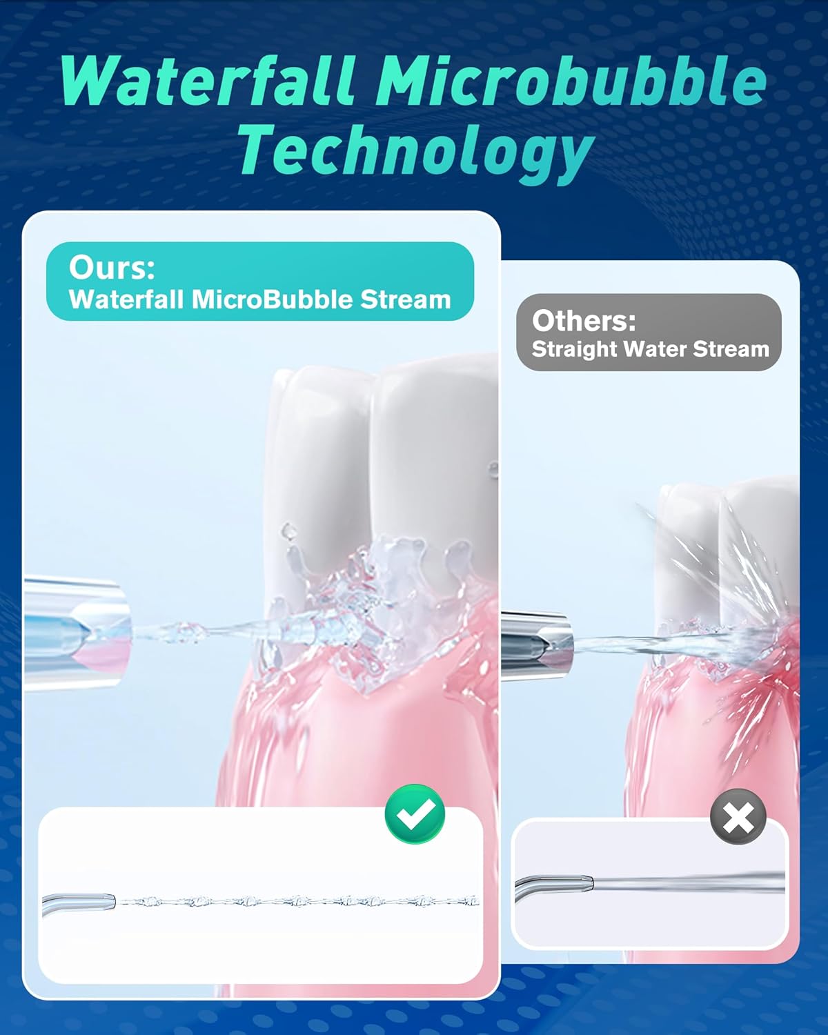 Thumbnail 1 de Glracd cordless water flosser with waterfall microbubble tech and DIY pressure modes