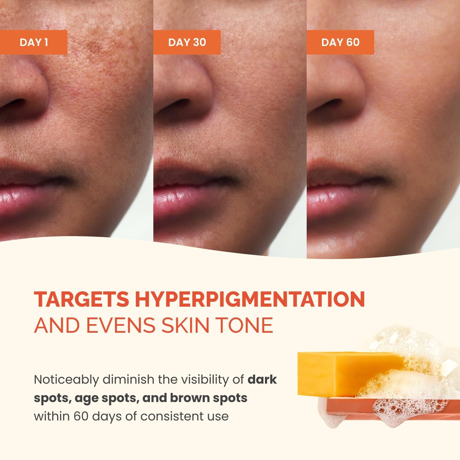 Detalle de PLANTIFIQUE Turmeric & Kojic Acid Soap – Lab Tested, 2 Bars for Dark Spots & Hyperpigmentation