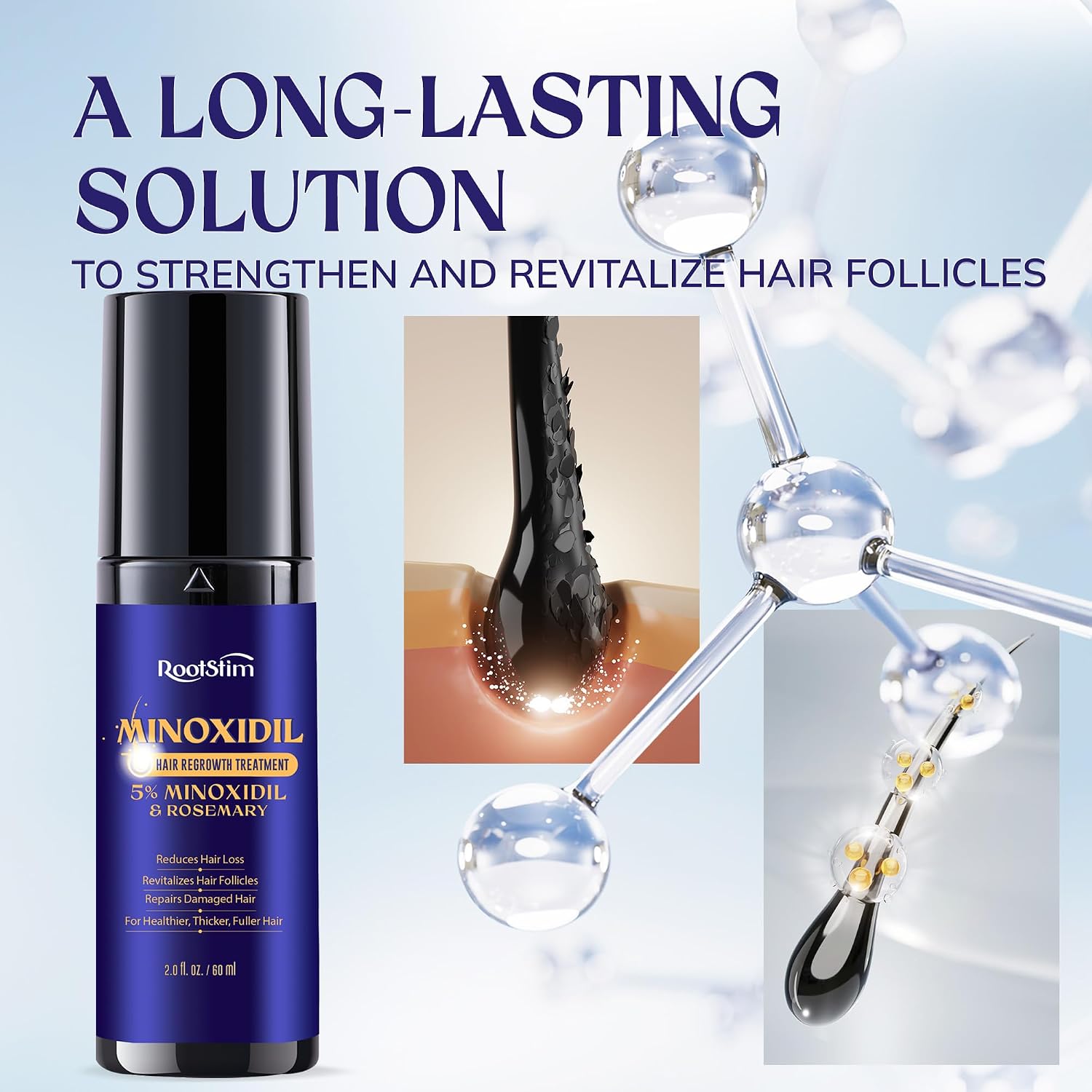 Thumbnail 6 de RootStim Minoxidil Hair Growth Treatment 180 mL