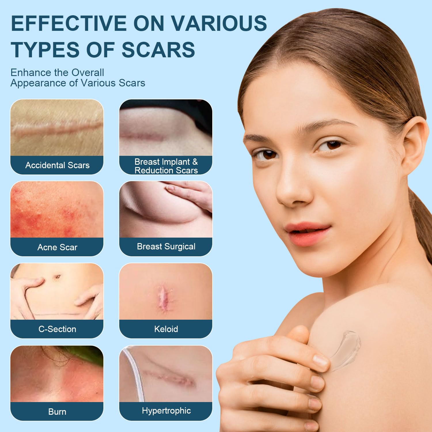 Detalle 2 de Mitgary Silicone Scar Gel 50g
