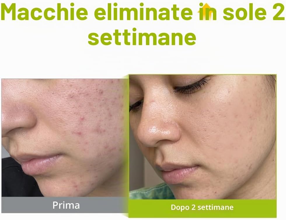 Thumbnail 3 de PURITO Acido Azelaico 10% Siero al Tè dell'albero Kojic e Tea Tree – tripla azione per imperfezioni e tono uniforme
