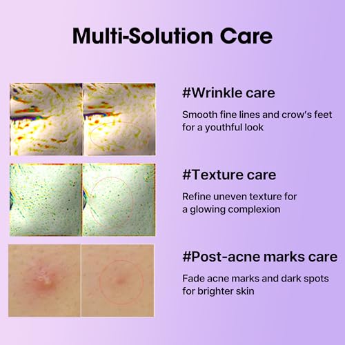 Thumbnail 4 de SOME BY MI Retinol Intense Serum 50 ml