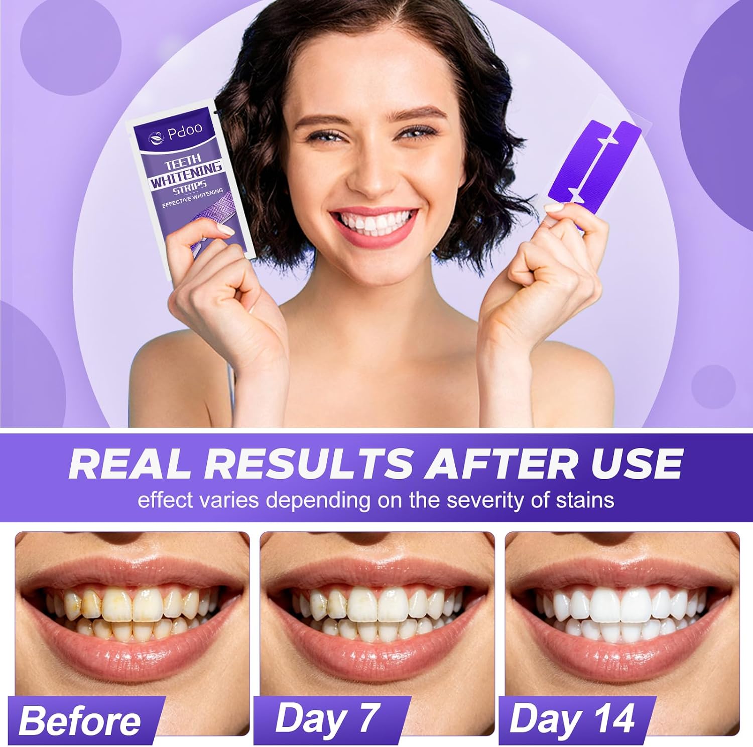 Detalle 2 de Purple Teeth Whitening Strips — 32 Strips (16 Uses) for Sensitive Teeth