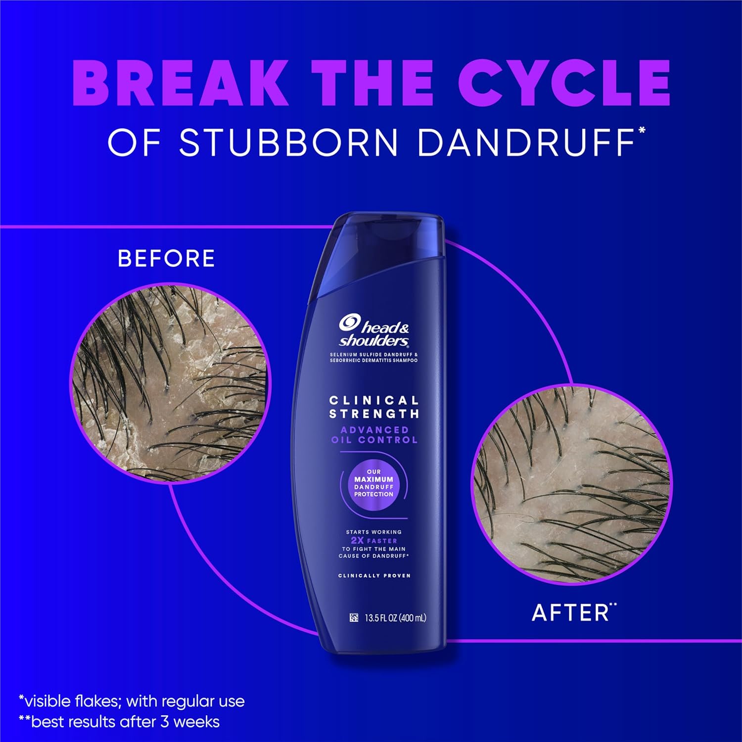 Thumbnail 3 de Head & Shoulders Clinical Strength 13.5 fl oz Shampoo