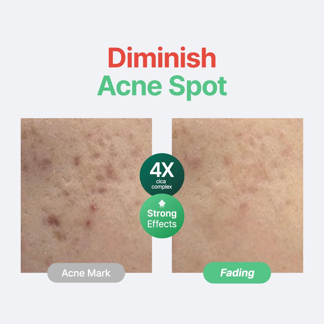 Detalle 2 de PURITO Centella Serum, 34,860 ppm ⚙