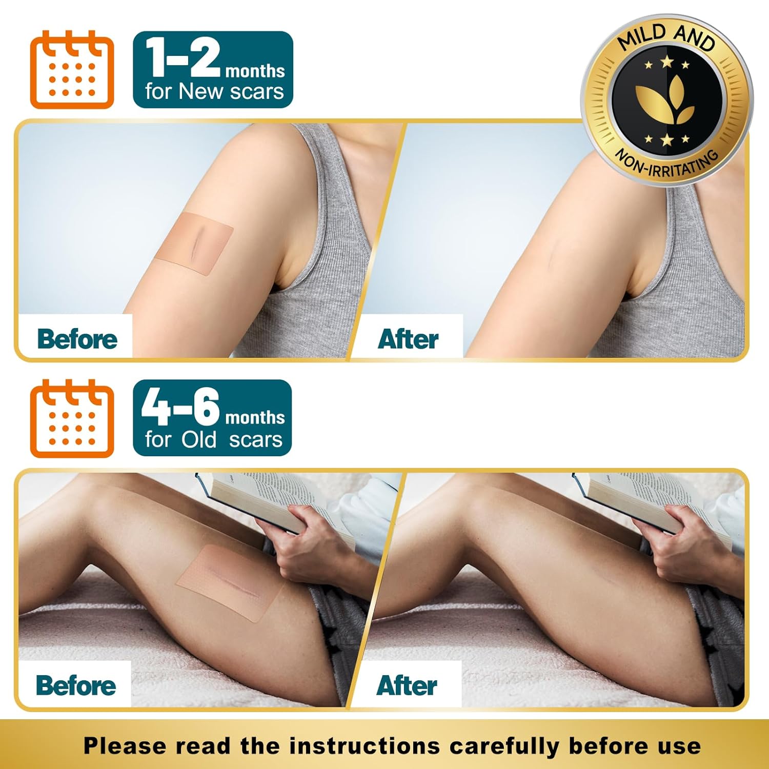 Thumbnail 4 de Arme Silicone Scar Tape: 2 rolls of 1.6" x 120" medical grade silicone scar sheets