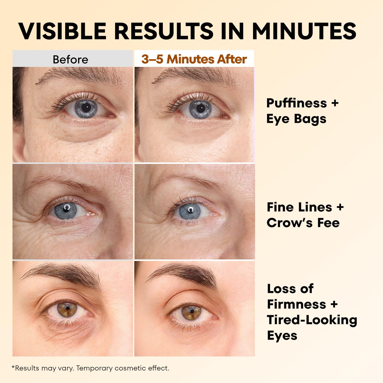 Thumbnail 2 de RONKIE Instant Firm Eye Tightener: Upgraded Formula for Women, 0.67 oz