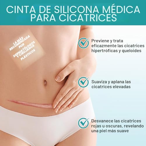 Detalle de NVXNMSD Silicone Scar Sheets: Parches de Silicona para Cicatrices Verdes, 1.6'' x 60