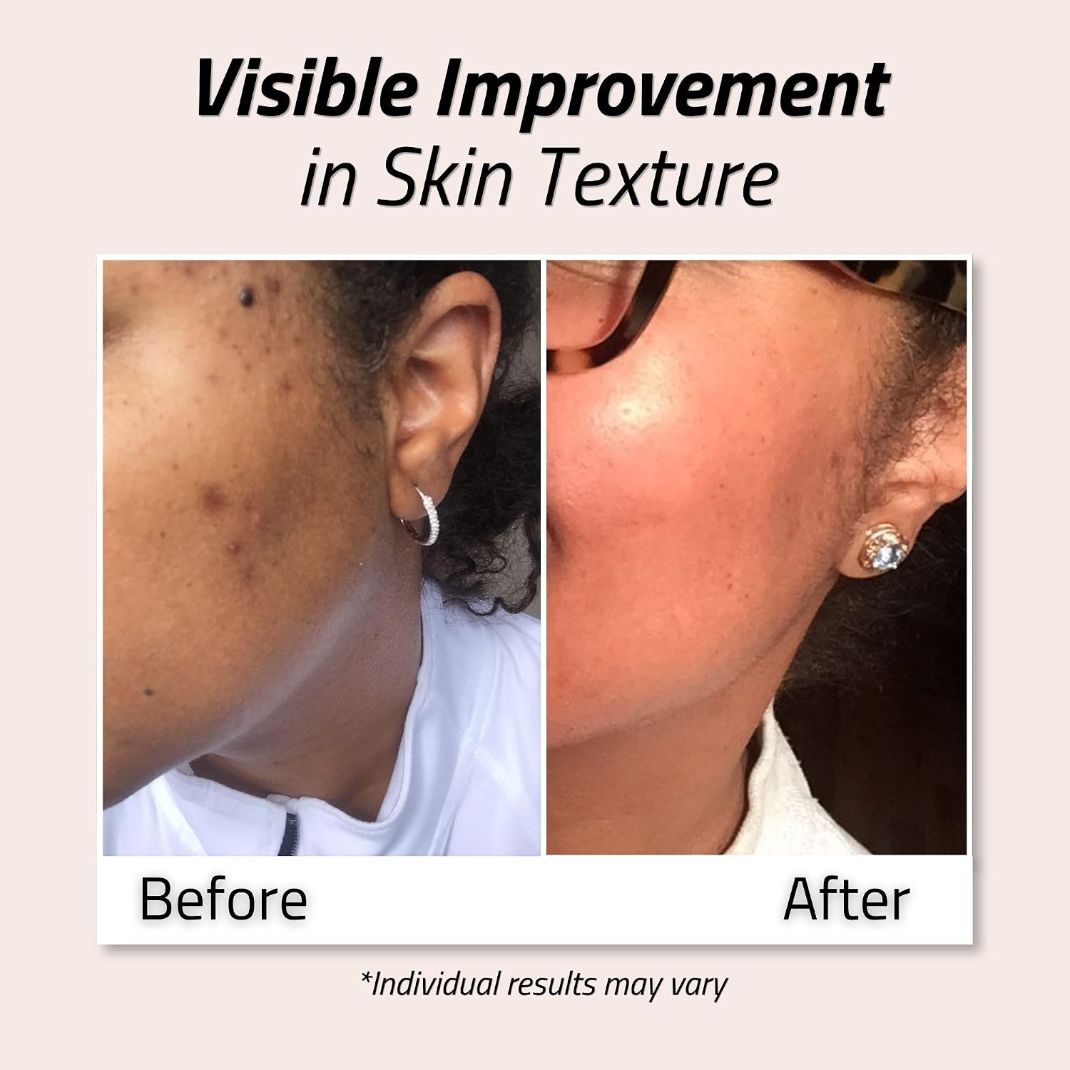 Detalle 2 de YEOUTH Glycolic Acid Toner 6 oz
