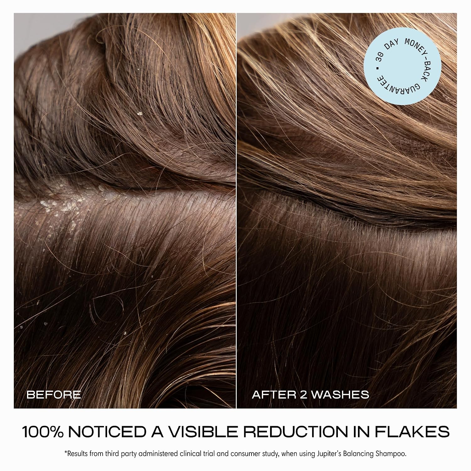 Thumbnail 3 de Jupiter Anti Dandruff Shampoo 1% Zinc Pyrithione