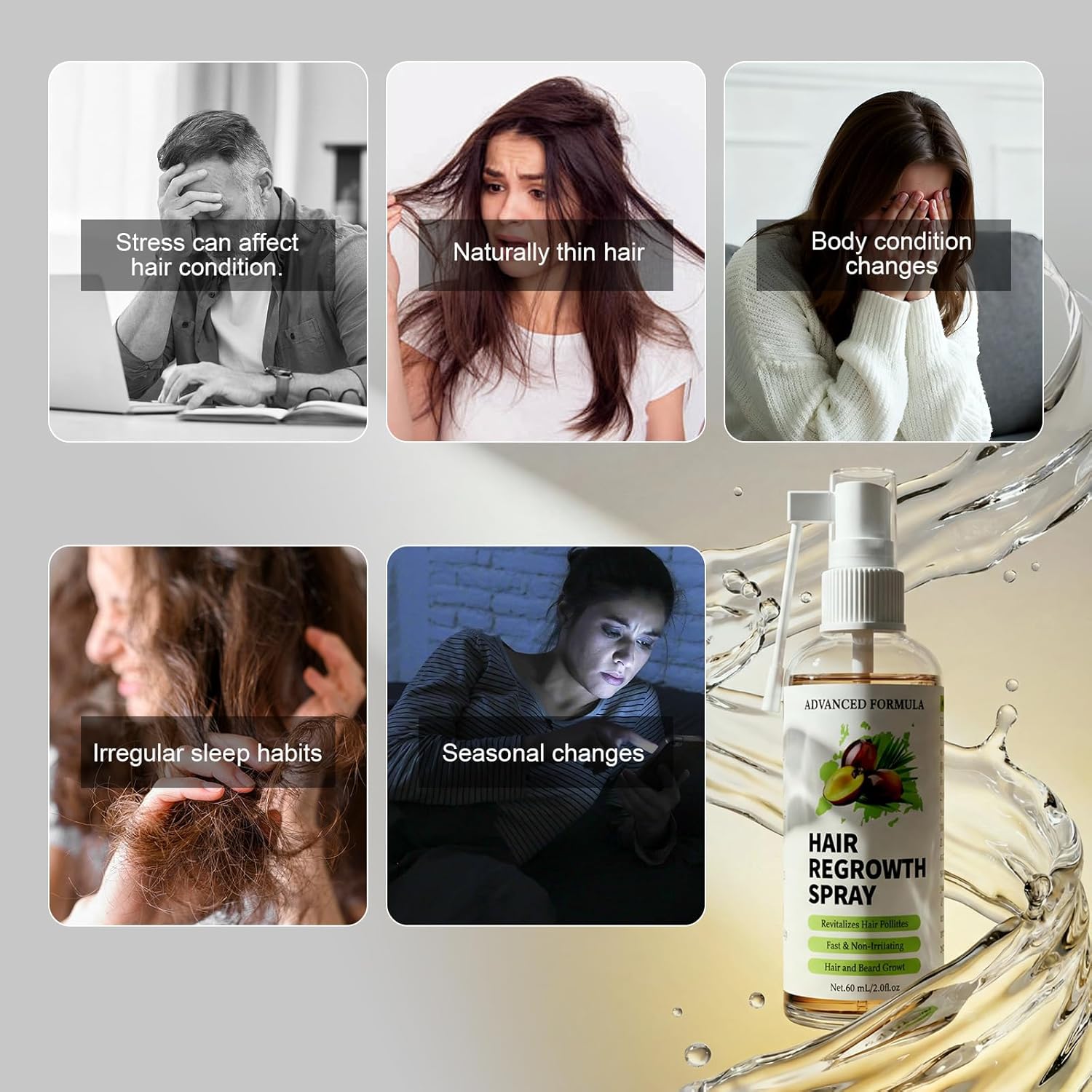 Detalle de Ballphl Siero Crescita Capelli Anticaduta 60 ml – Lozione spray a base di rosmarino, biotina, olio di ricino e batana