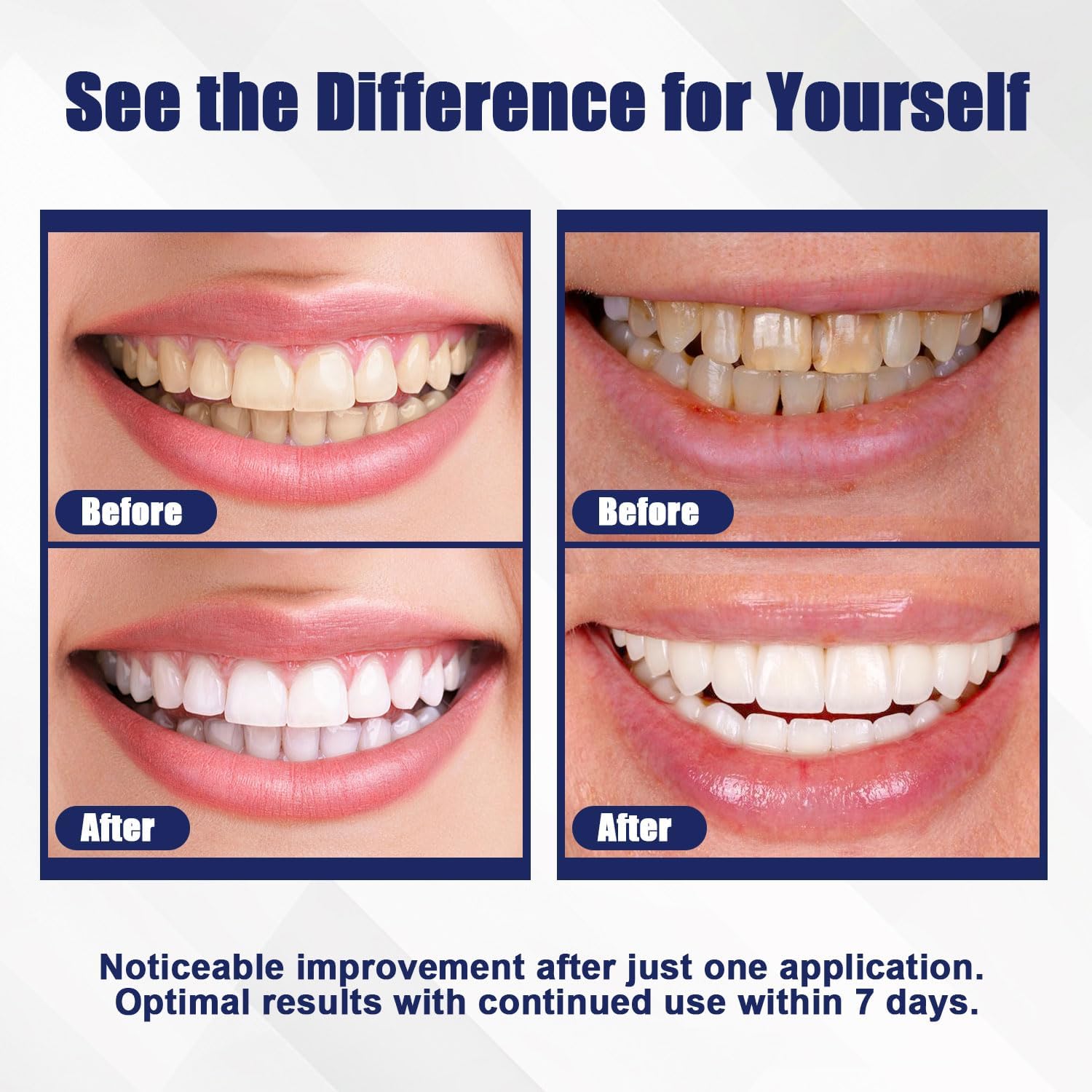 Detalle 2 de KAKUJ Teeth Whitening Strips 14 Treatments