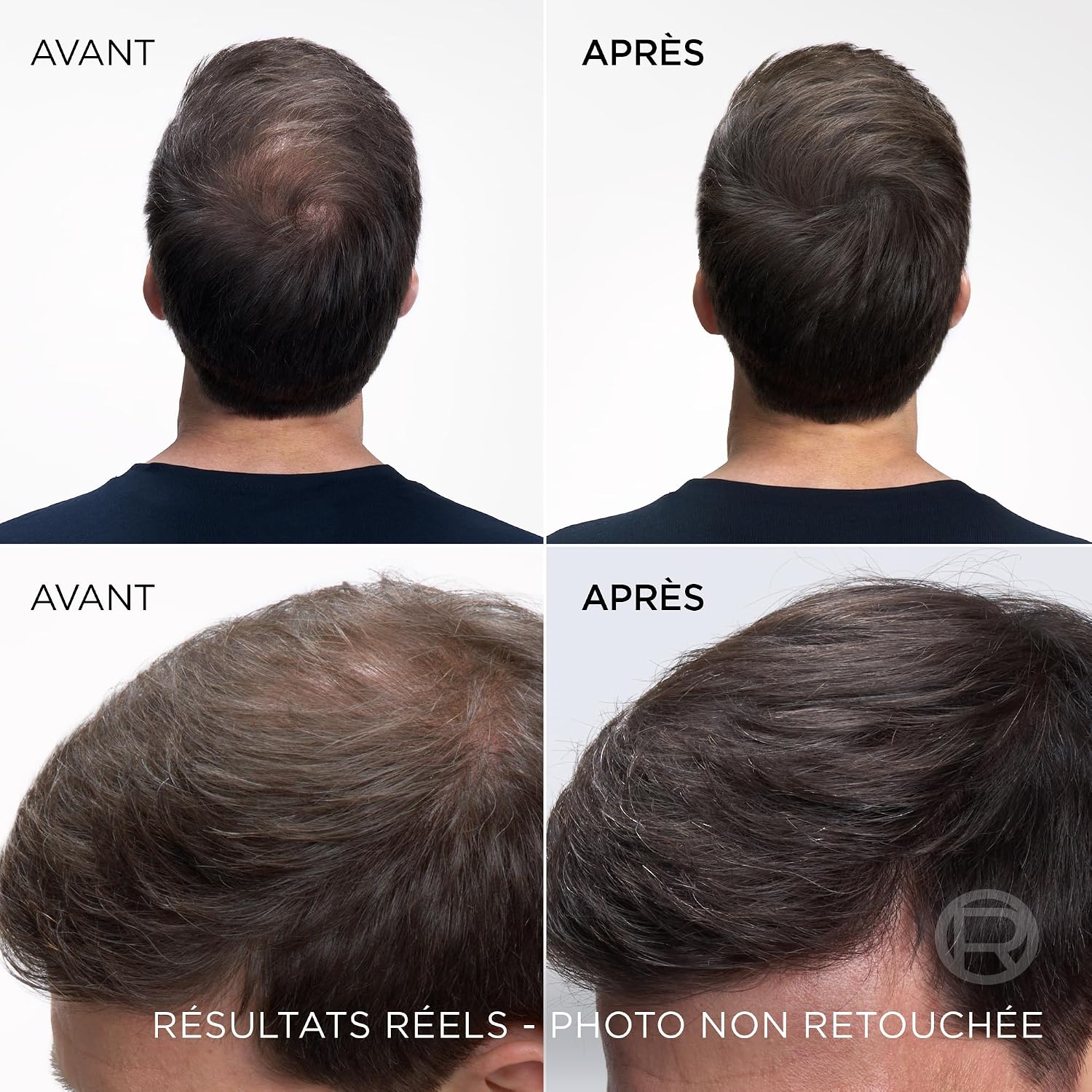 Thumbnail 3 de L’Oréal Paris Magic Retouch - Spray Correcteur Instantané des racines, Châtain Foncé 75 ml