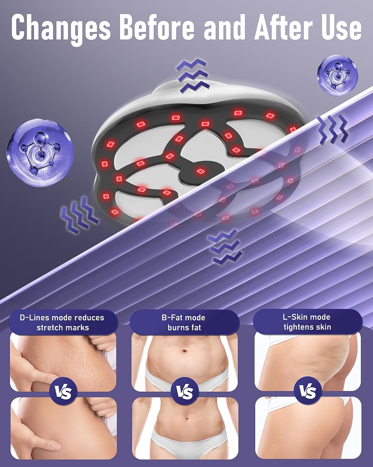 Detalle de Wagxoey Cellulite Massagegerät – Lymphdrainage mit Heizfunktion, 15 Stufen, 3 Modi