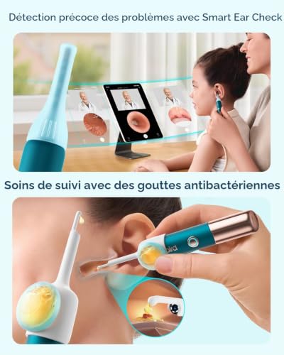 Thumbnail 6 de Bebird Earsight Ultra Détartrant pour Oreilles avec 5G-WLAN et Otoscope HD 1080P – kit complet