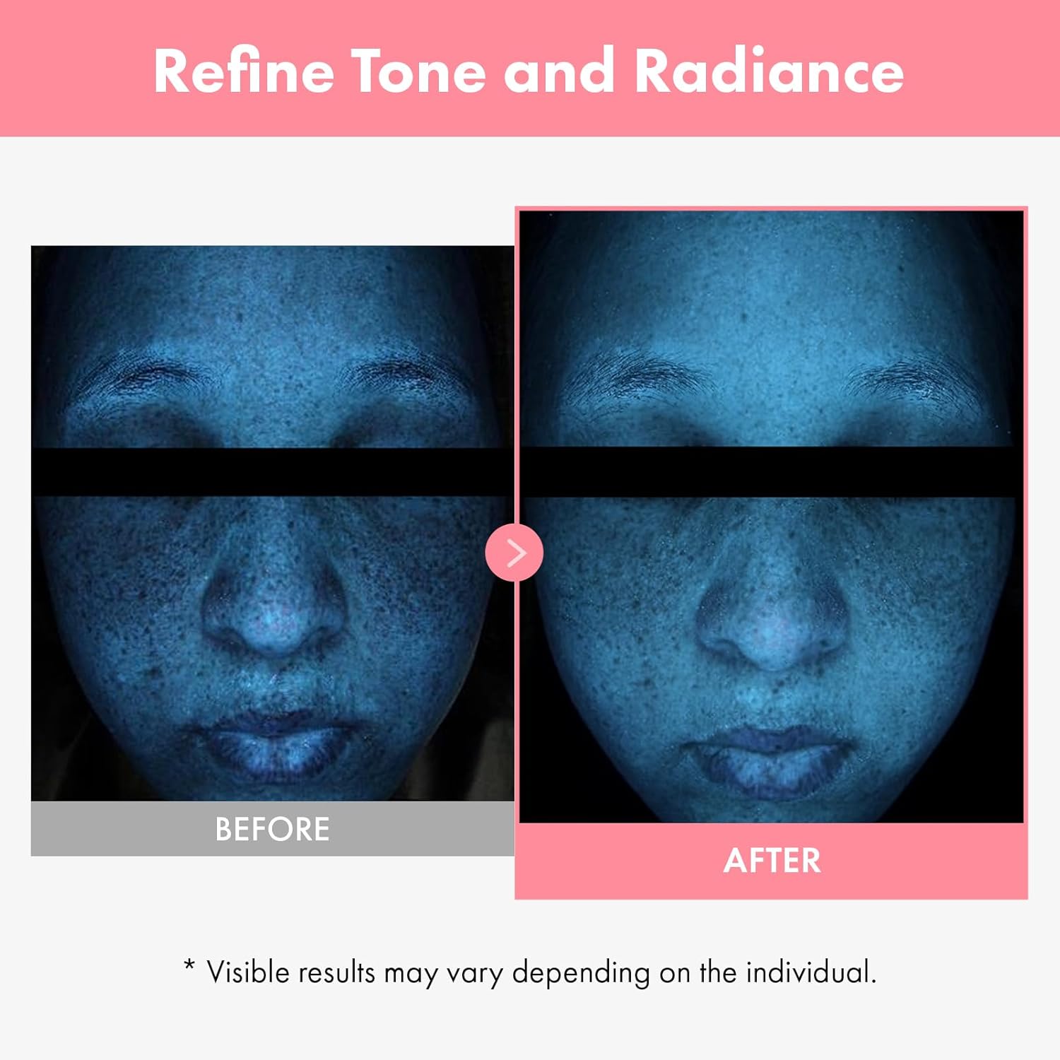 Thumbnail 2 de TOSOWOONG Crema PDRN Hyaluron viso con DNA di salmone e niacinamide, 50 ml