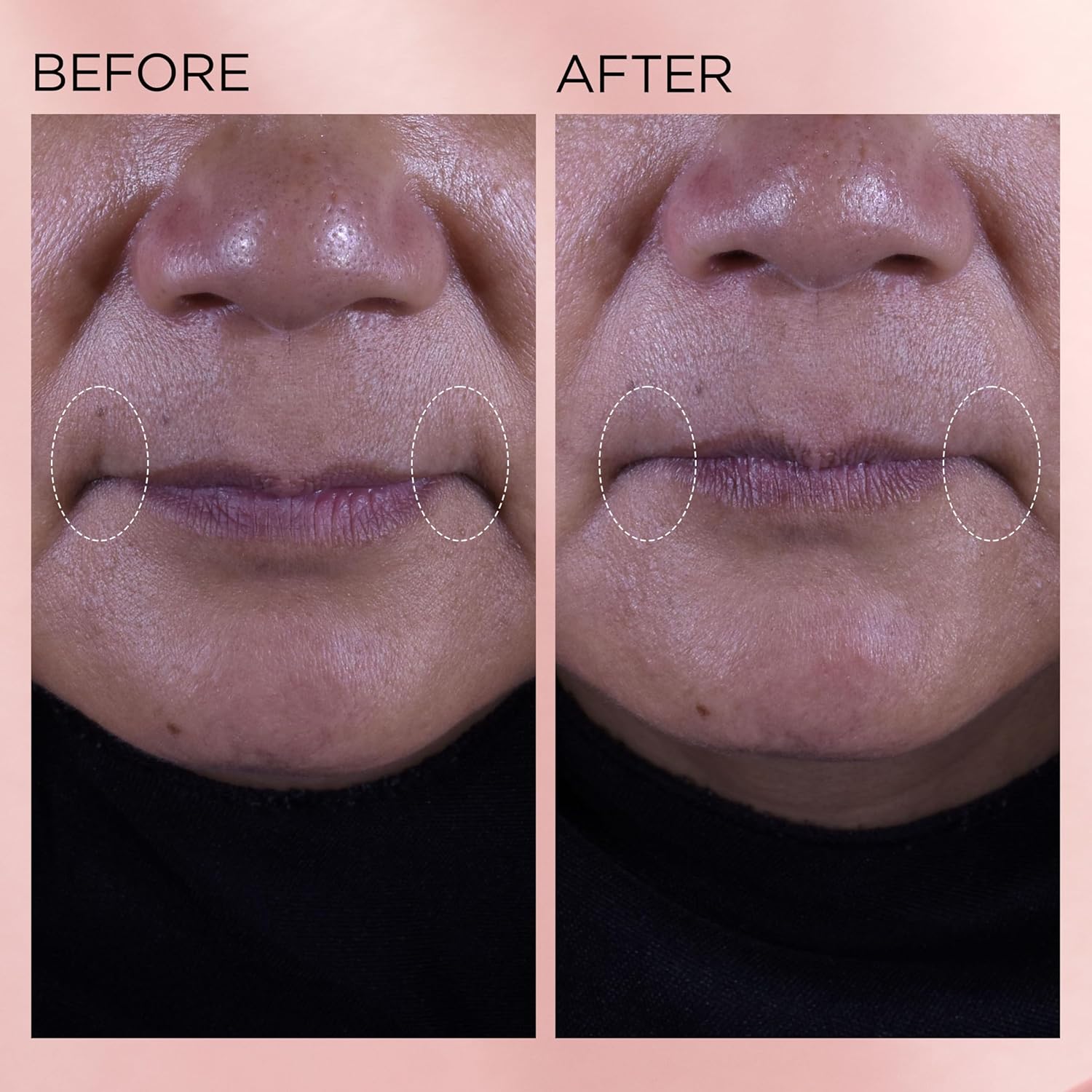 Thumbnail 6 de Elizabeth Arden Retinol + HPR Crema 50 ml