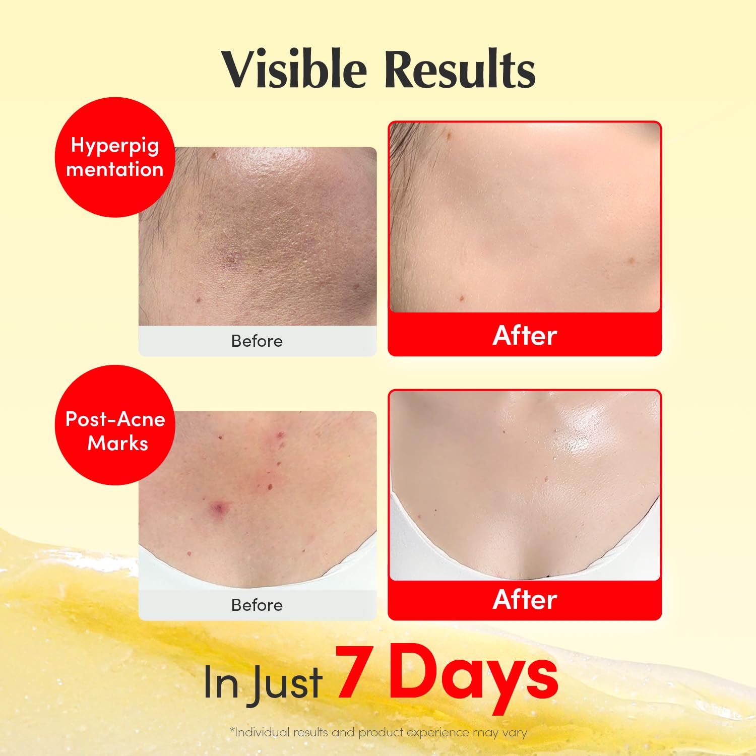 Thumbnail 3 de EQQUALBERRY Vitamin Illuminating Cream (Vitamin C, 5% Niacinamide, 3% TXA) for Dark Spots & Brightening