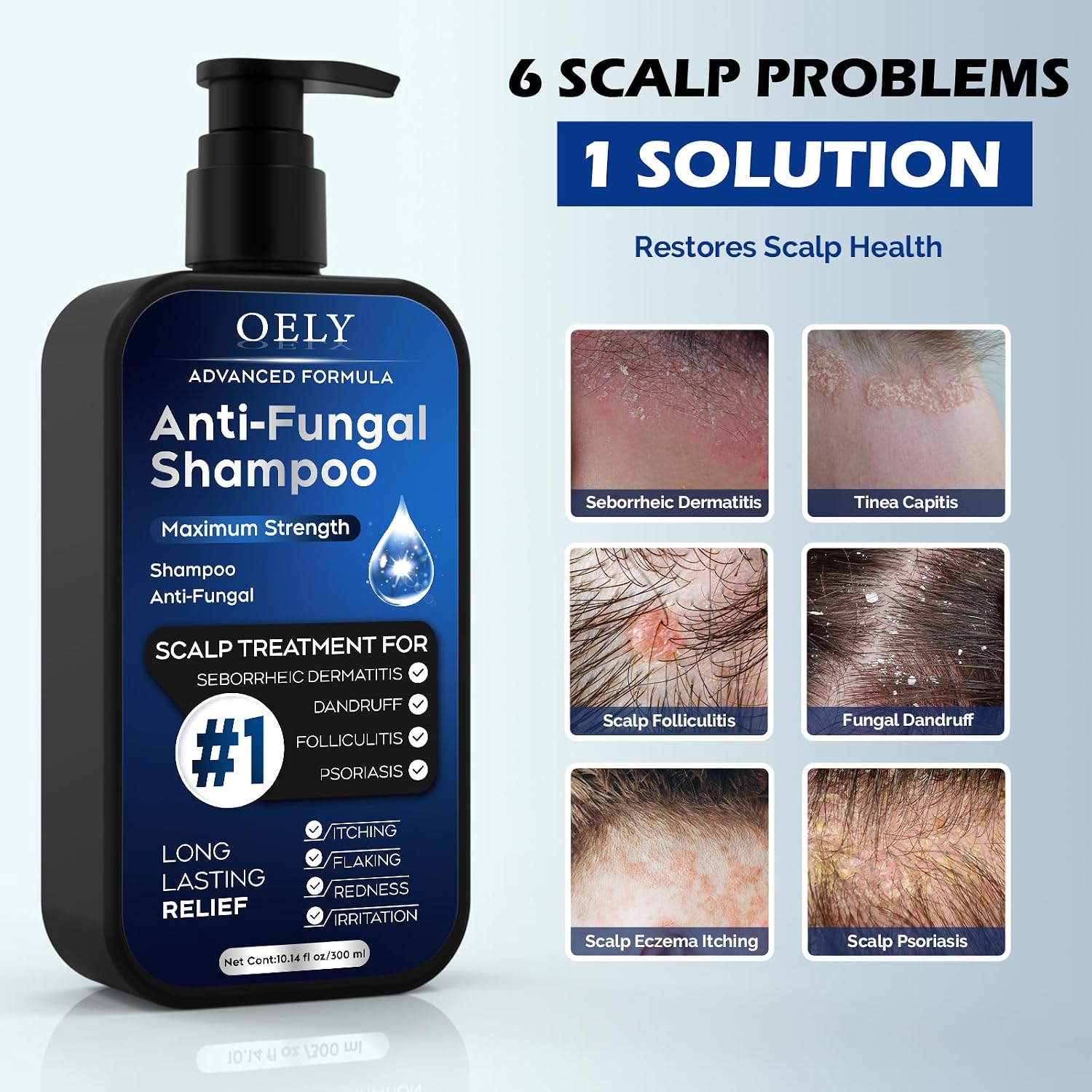 Detalle de Oely Antifungal Shampoo, 10.1 fl oz
