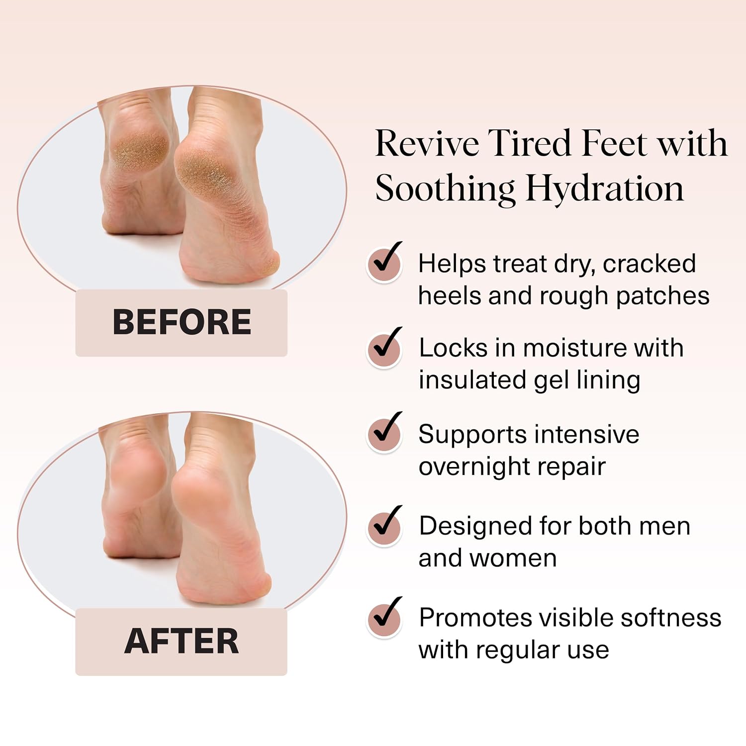Detalle de Kitsch Moisturizing Socks for Cracked Heels 1 pair
