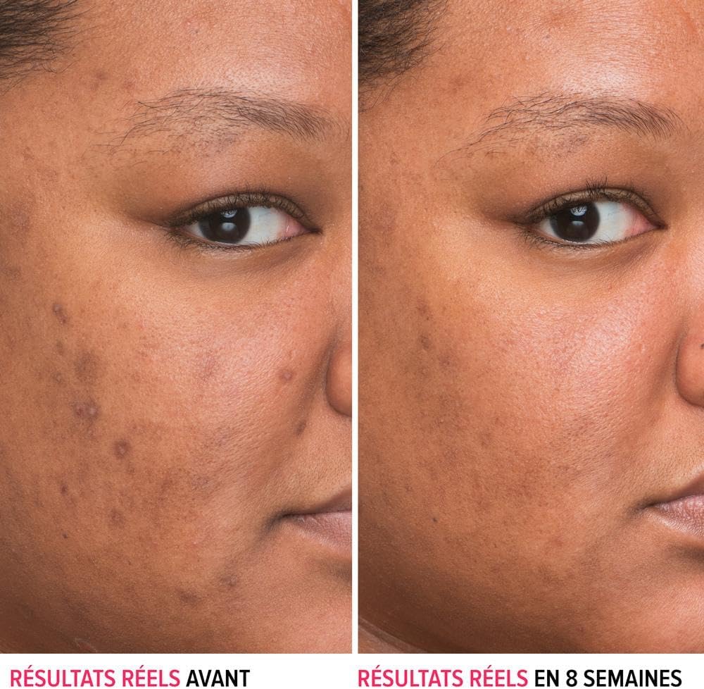 Thumbnail 1 de IT Cosmetics Bye Bye Dark Spots Serum
