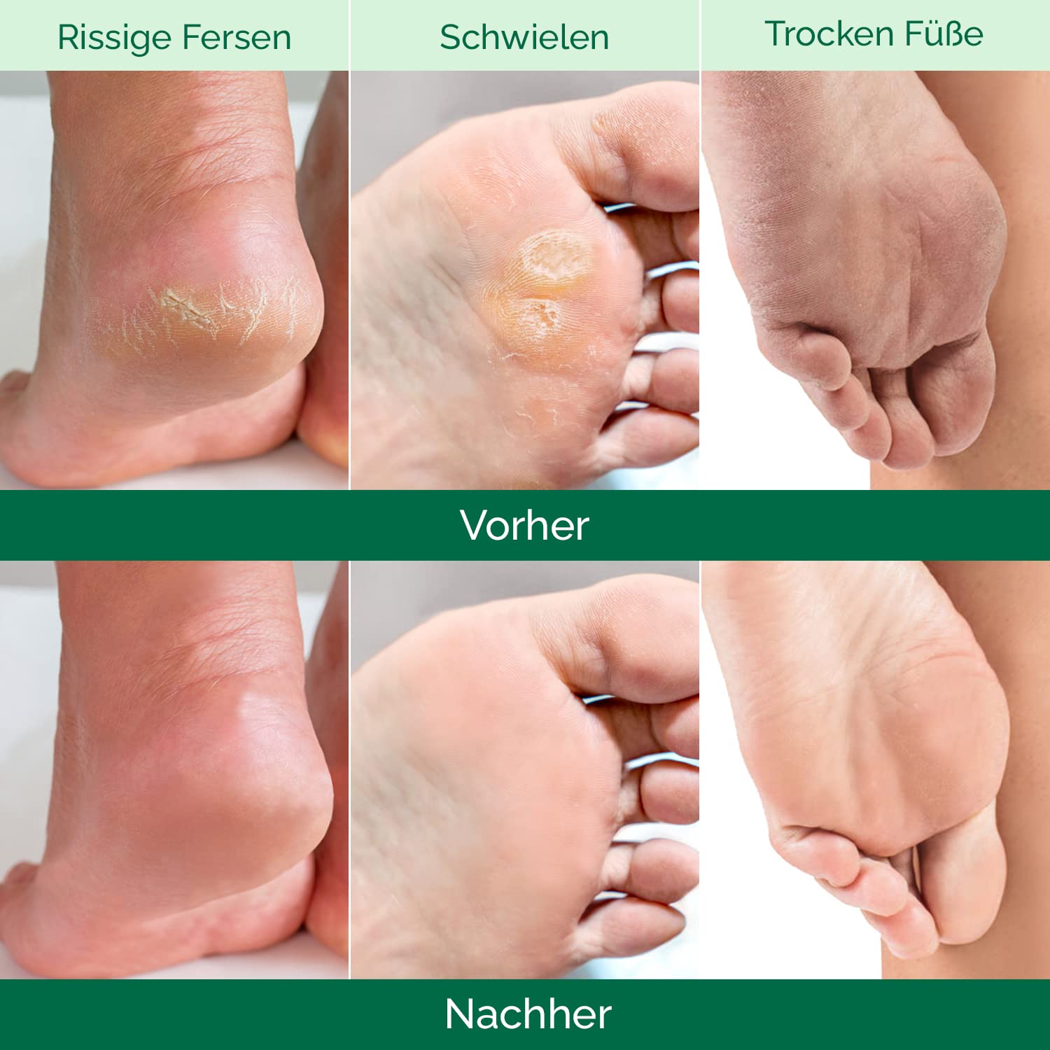 Thumbnail 2 de Plantifique Fußmaske: 2 Paar Hornhaut-Socken (Hornhautentferner) für Männer