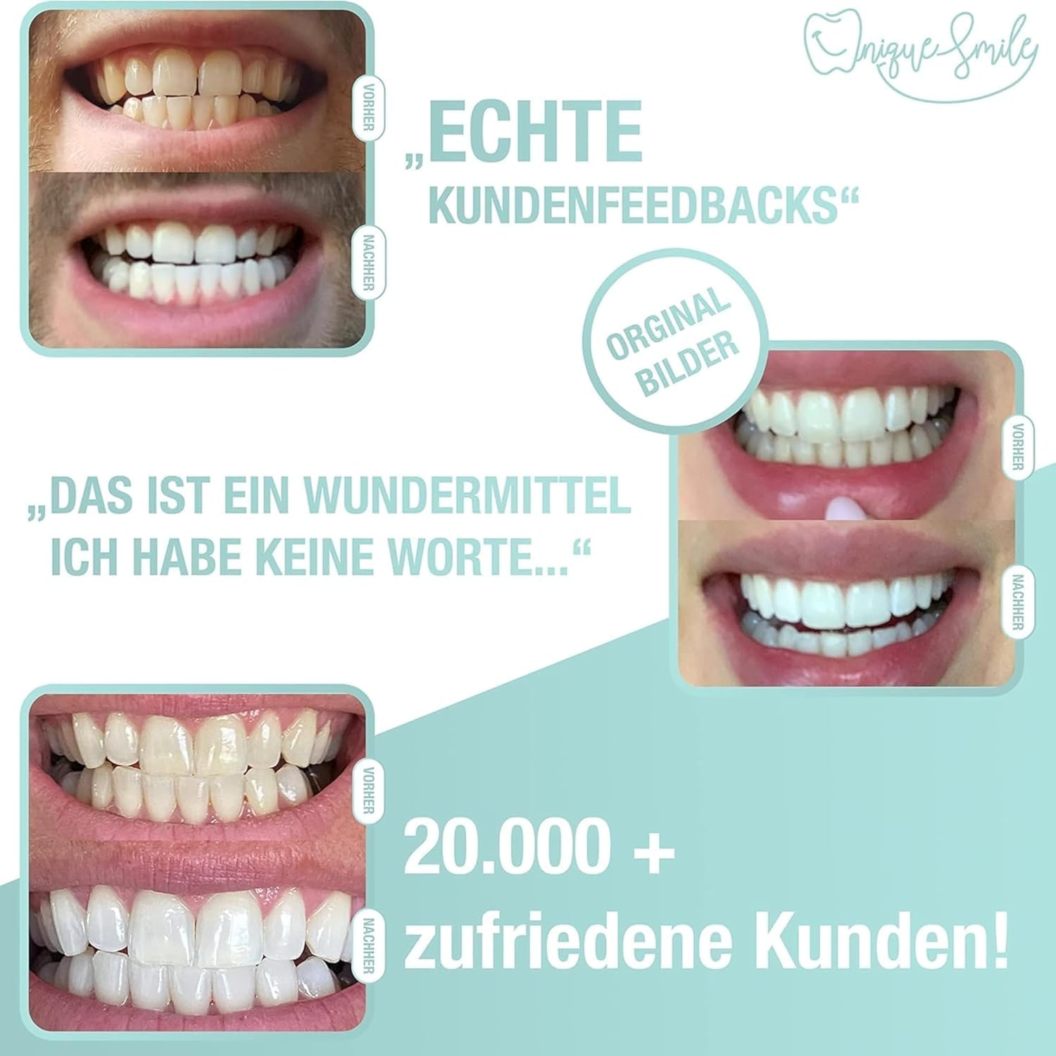 Detalle de UniqueSmile Teeth Whitening Kit (Basic-Set) – All-in-One Bundle für schnelle Zahnaufhellung