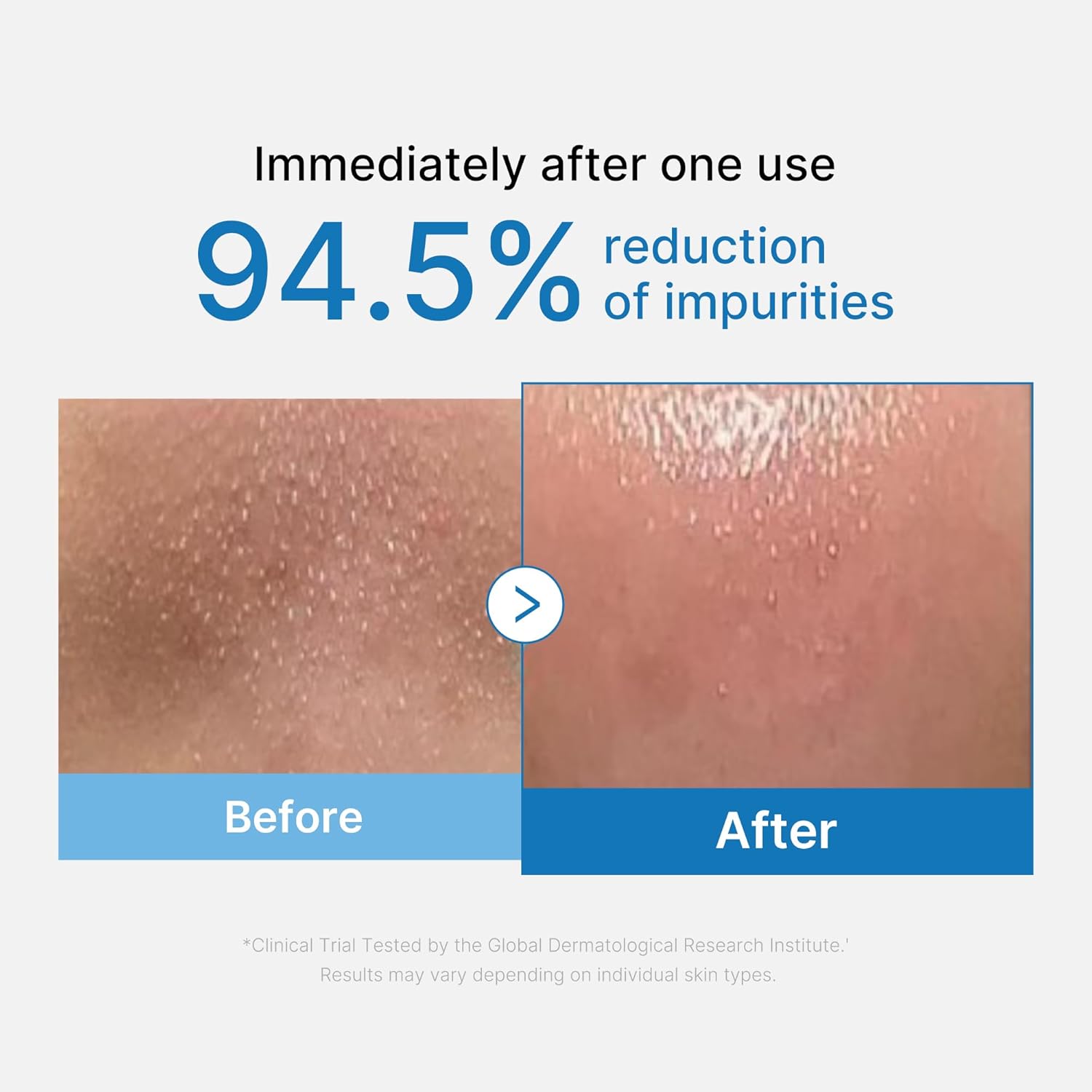 Detalle 2 de medicube Zero Pore Blackhead Cleansing Oil – Porenreinigendes Make-up-Entferner-Öl für alle Hauttypen (205 ml)