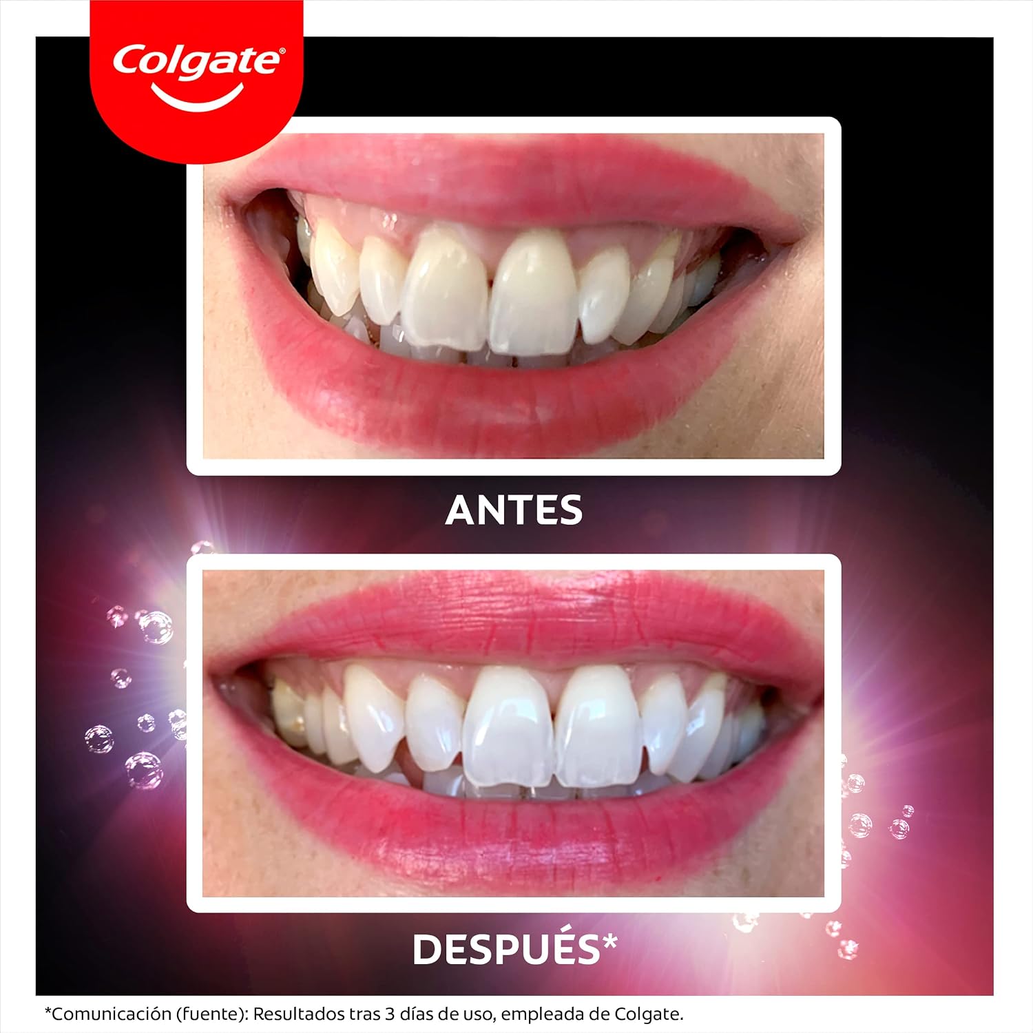 Detalle de Colgate Max White Ultra Active Foam Zahnpasta 2x75 ml – Weißere Zähne in 3 Tagen (Kollektion)