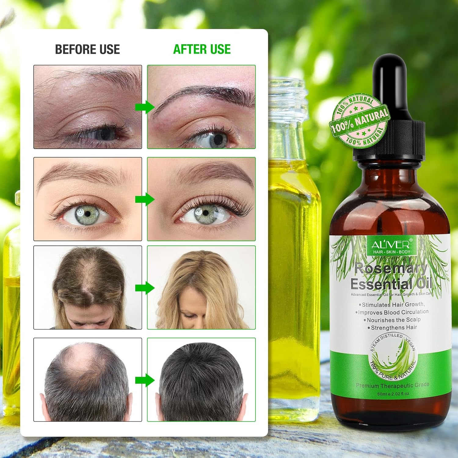 Thumbnail 4 de Olio di rosmarino per la crescita dei capelli 60ML - Premium naturale con massaggiatore del cuoio capelluto in silicone
